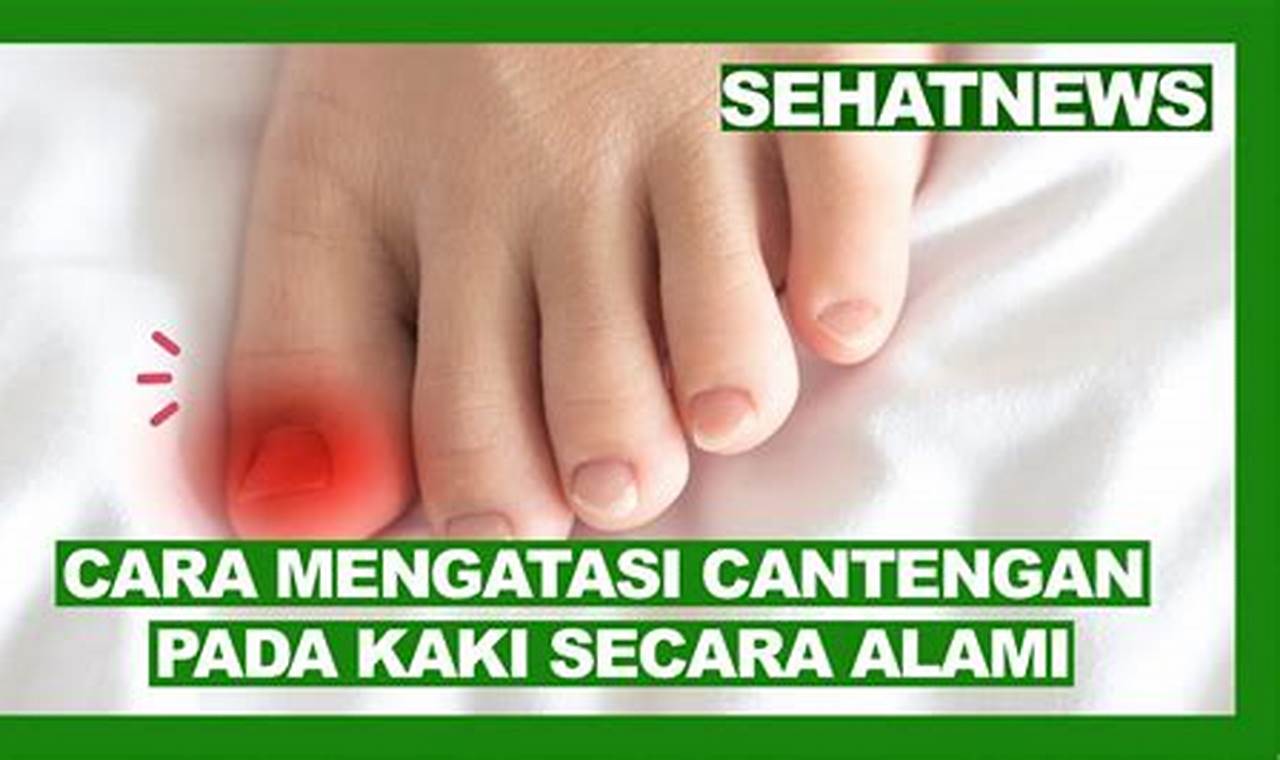 Cara Mengatasi Kaki Cantengen